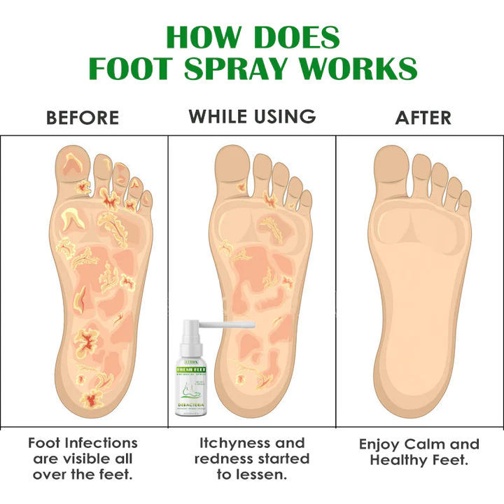 Gutp FreshFeet Debacteria Botanical Spray - Image 3