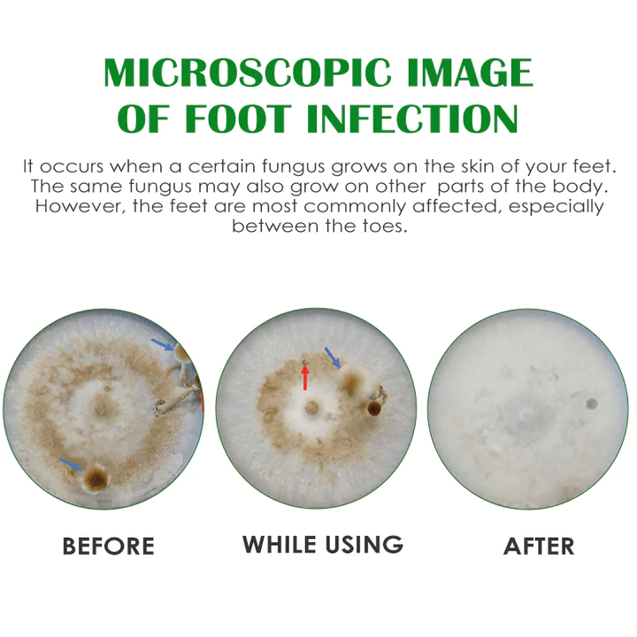 Gutp FreshFeet Debacteria Botanical Spray - Image 6