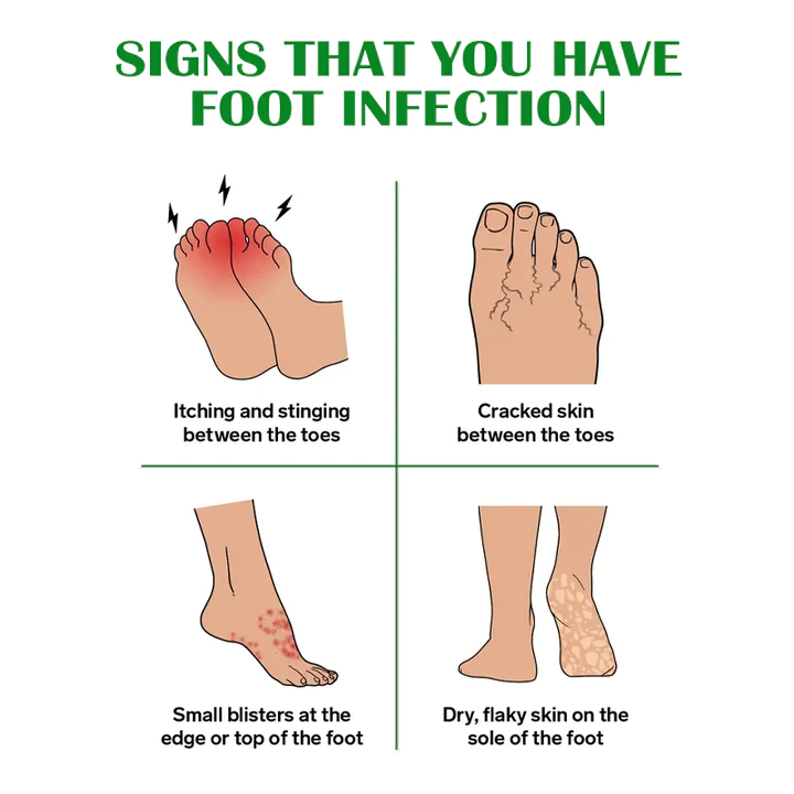 Gutp FreshFeet Debacteria Botanical Spray - Image 7
