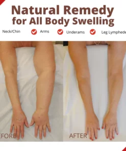 HeaLymph™ Treatment Patch