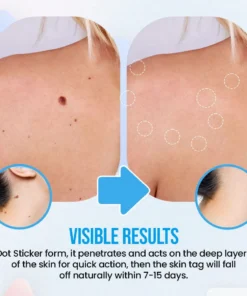 Herbal Extract Warts Clear Dot Stickers