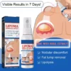 Herbal Lipoma Removal Spray