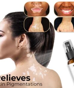 IMAGS™ Vitiligo Relief Spray