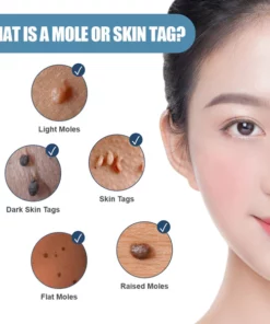 Juenow™ Clearasil Bruise Relief Cream