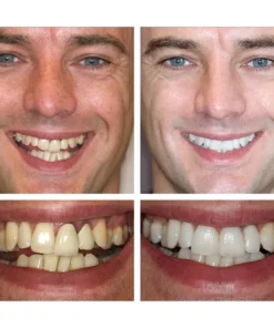 Lanthome™ Esencia blanqueadora de dientes