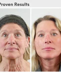 Loqam® Luxury Hyaluronic Acid Anti-Aging Serum