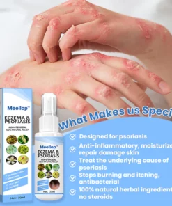 Meellop™ Herbal Psoriasis Relief Spray
