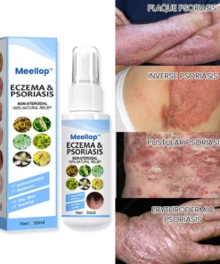 Meellop™ Herbal Psoriasis Relief Spray