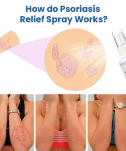 Meellop™ Herbal Psoriasis Relief Spray