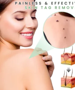 MicroDarts Spot Removal Patch