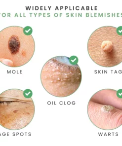 MicroDarts Spot Removal Patch