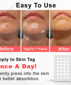 MicroDarts Spot Removal Patch