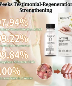 NailGro™ Intense Nail Growth and Strengthening Serum
