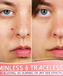 Organic Skin Purifying Dark Spot Serum