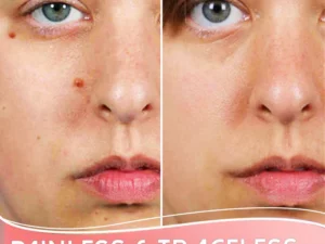 Organic Skin Purifying Dark Spot Serum