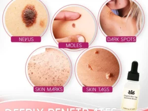 Organic Skin Purifying Dark Spot Serum