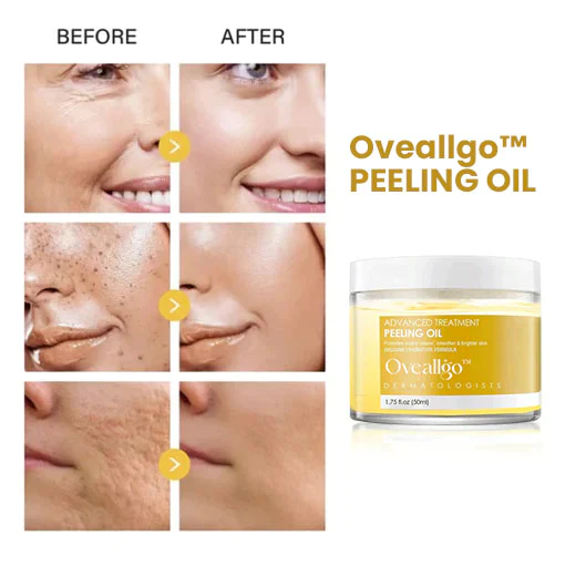Oveallgo™ 30 Days Anti-Wrinkle Exfoliate Peeling Oil - Image 3