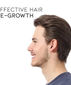 Alternative view of Oveallgo™ Herbal Roller and Essence Set