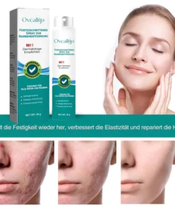 Alternative view of Oveallgo™ LUX Fortgeschrittenes Spray zur Narbenentfernung