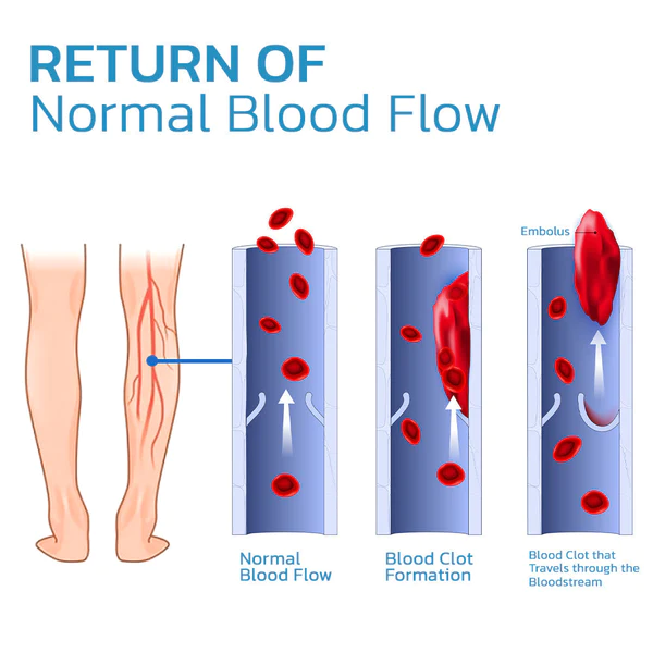 Peaufit™ TitanVein Far Infrared Tourmaline Acupressure Insoles - Image 4