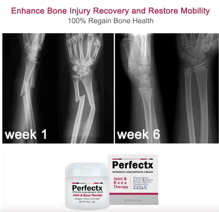 PerfectX Joint And Bone Therapy Cream - Image 2