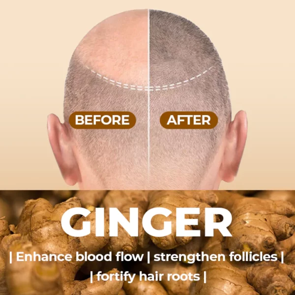 SalonX™ Natural Ginger Hair Growth Shampoo Bar Wowelo Your Smart