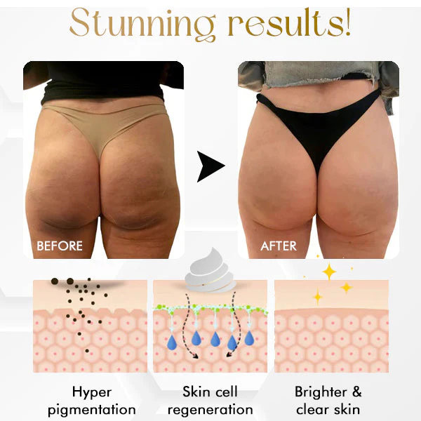 SkinGlow™ Whitening Repair Cream - Image 4