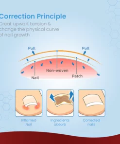 ToenailPro™ German Paronychia Relief Patch