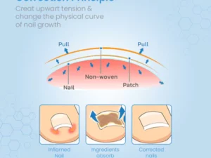 ToenailPro™ German Paronychia Relief Patch