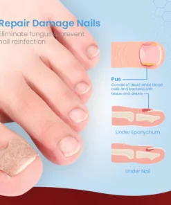 ToenailPro™ German Paronychia Relief Patch