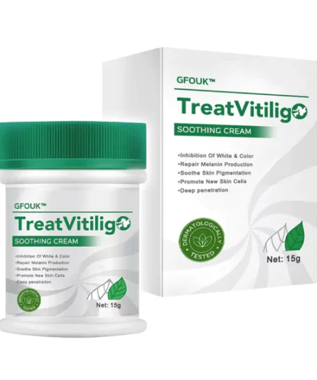 TreatVitiligo Soothing Cream