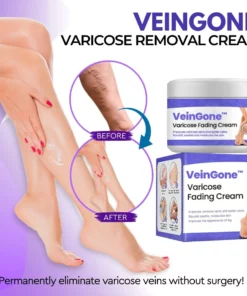 Alternative view of VeinGone™ Varicose Fading Cream