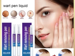 Wart removing pen
