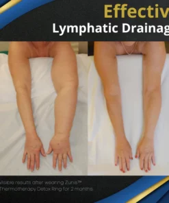Zunis™ Thermotherapy Detox Ring