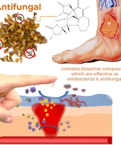 flysmus™ Bed Sore Renewal Cream