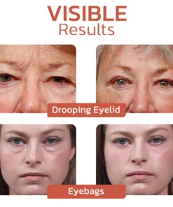 flysmus™ CaffeineEYES Repair and Lifting Augencreme