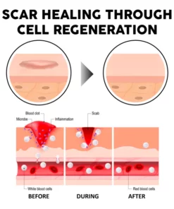 Alternative view of ATTDX Advanced ScarRemoval Moisturizing Spray