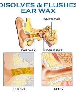 Alternative view of ATTDX AntiChochlear BlockageRemoval Spray