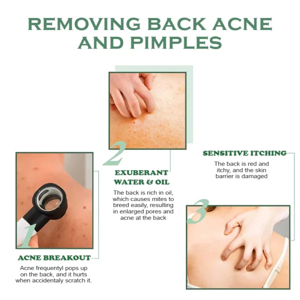 Spray netejador per eliminar l'acne corporal ATTDX