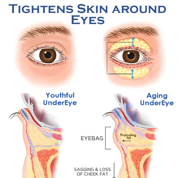 ATTDX קפאין EyeDepuffing LiftingGel