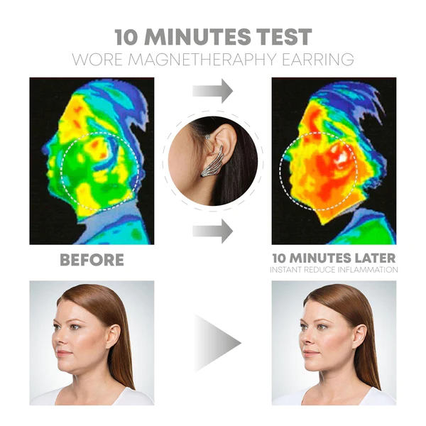 AcupressureDetox AngelWings EarCrawler - Image 3