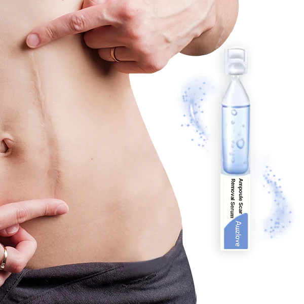 Awzlove™ Ampoule Scar Removal Serum - Image 2