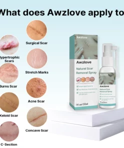 Awzlove™ Natural Advanced Scar Spray