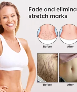 Awzlove™ Natural Advanced Scar Spray