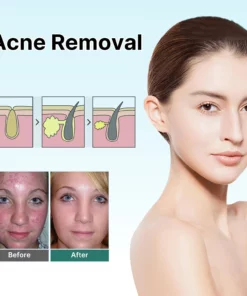 Awzlove™ Natural Advanced Scar Spray