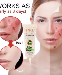 Alternative view of BOZEBI™ Advanced Tags & Moles Remover