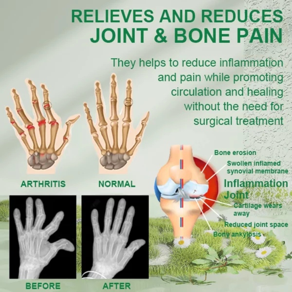 Beevana™ Kudan zuma Joint Joint & Bone Therapy Cream