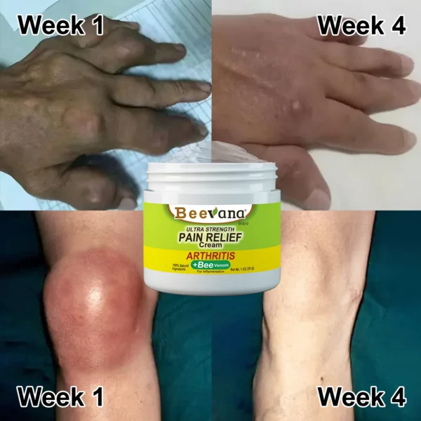 Beevana™ 蜂毒關節和骨骼治療霜