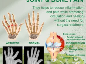Beevana™ Bee Venom Joint & Bone Therapy Cream