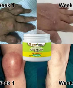 Beevana™ Bee Venom Joint & Bone Therapy Cream